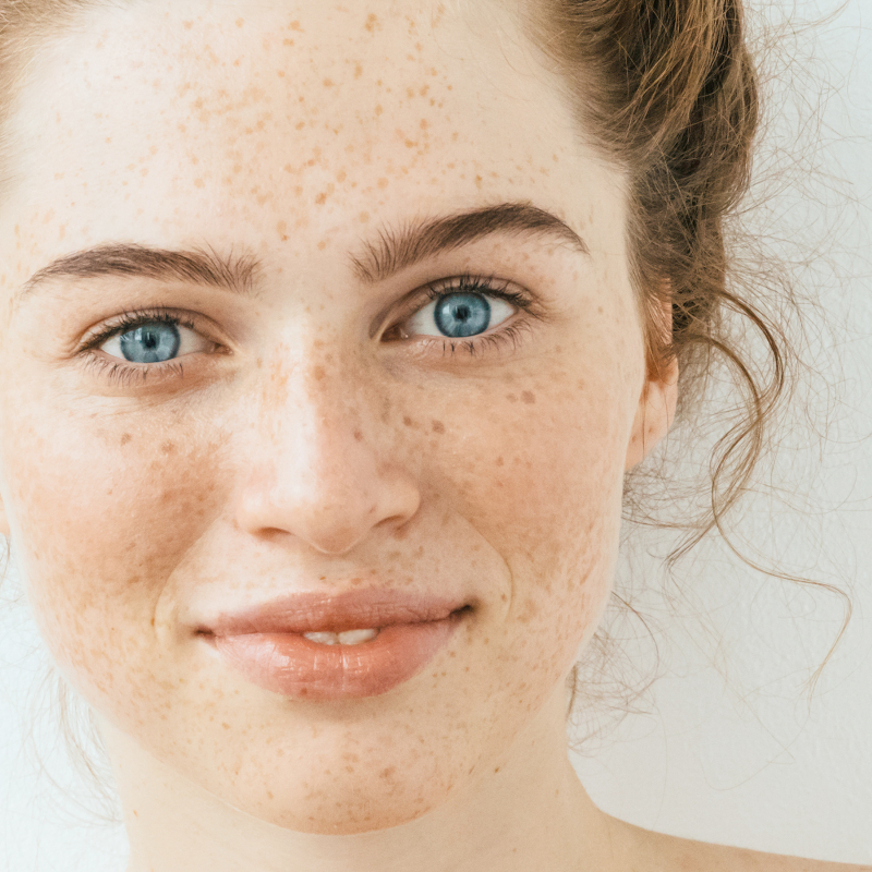 Die h&auml;ufigsten Hauterkrankungen bed&uuml;rfen abgestimmter Pflege